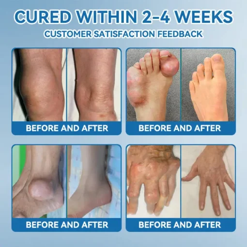 AAFQ® BPC-157 Joint Healing Cream
