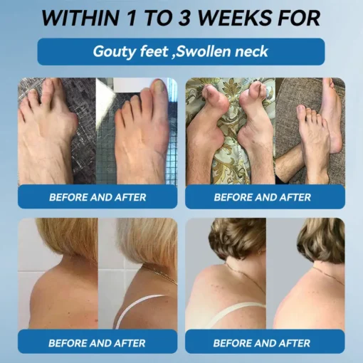 AAFQ® BPC-157 Joint Healing Cream