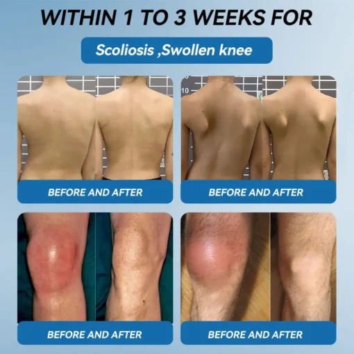 AAFQ® BPC-157 Joint Healing Cream