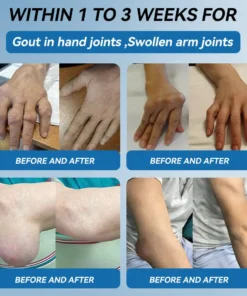 AAFQ® BPC-157 Joint Healing Cream