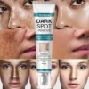 Bloobeac® Blemish Removing Beauty Cream