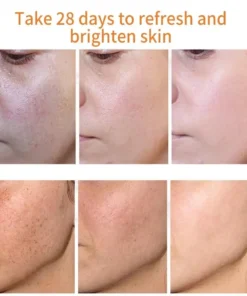 Bloobeac® Blemish Removing Beauty Cream