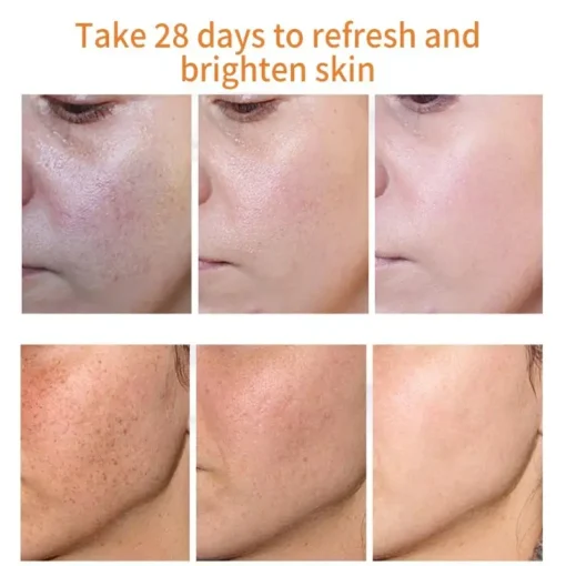 Bloobeac® Blemish Removing Beauty Cream