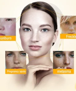 Bloobeac® Blemish Removing Beauty Cream