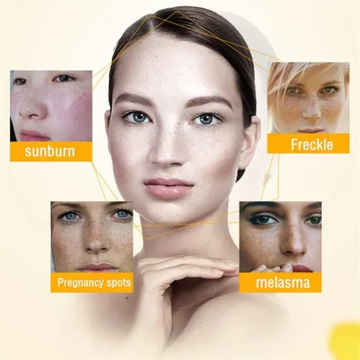 Bloobeac® Blemish Removing Beauty Cream
