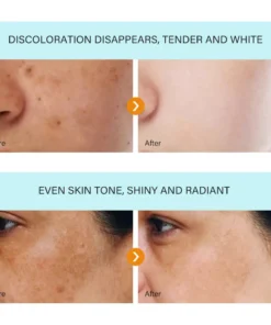 Bloobeac® Blemish Removing Beauty Cream