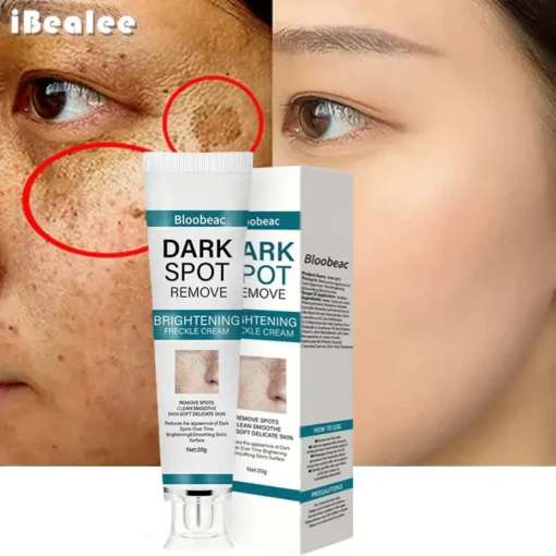 Bloobeac® Blemish Removing Beauty Cream