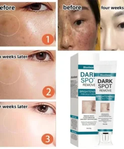 Bloobeac® Blemish Removing Beauty Cream
