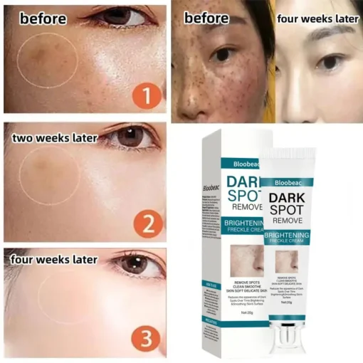 Bloobeac® Blemish Removing Beauty Cream