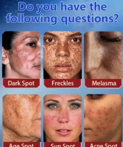 Bloobeac® Blemish Removing Beauty Cream