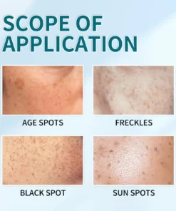 Bloobeac® Blemish Removing Beauty Cream