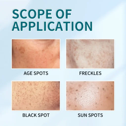 Bloobeac® Blemish Removing Beauty Cream