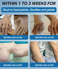 HONXI® BPC-157 Joint Healing Cream