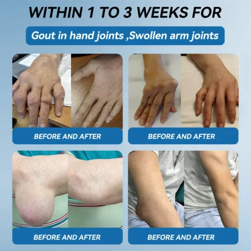 HONXI® BPC-157 Joint Healing Cream