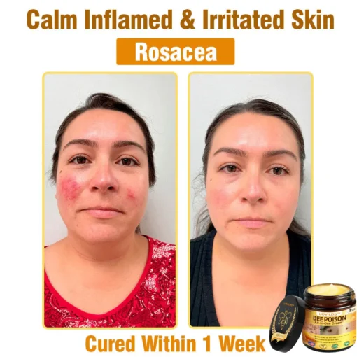 LOVILDS™ Bee Poison All-in-One Cream