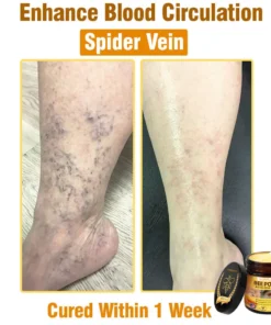LOVILDS™ Bee Poison All-in-One Cream