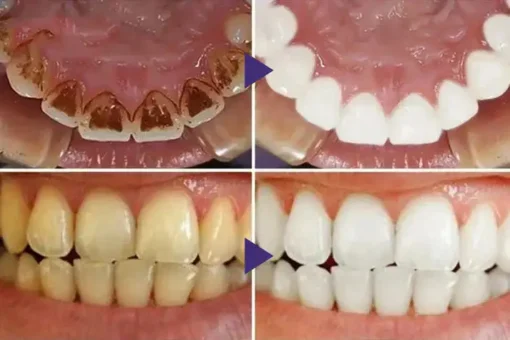LOVILDS™ Gum Care Gel