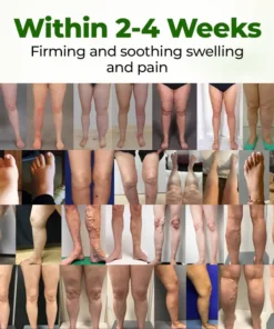 Tiworld®Professional Leg Circulation Cream