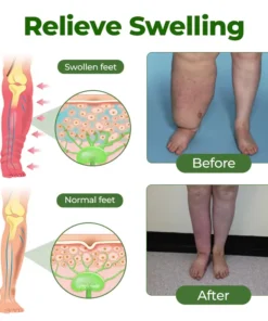 Tiworld®Professional Leg Circulation Cream