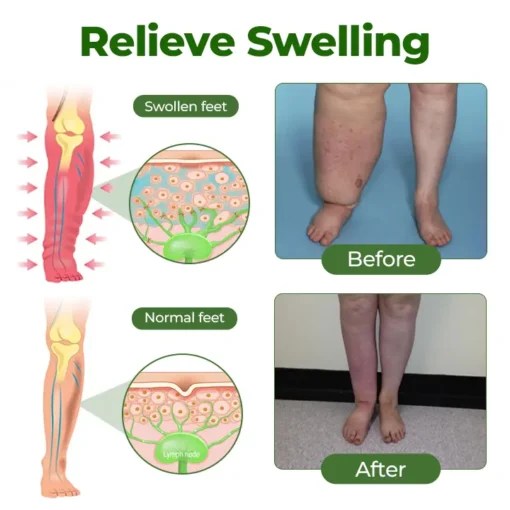 Tiworld®Professional Leg Circulation Cream