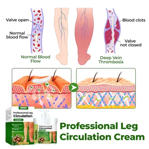 Tiworld®Professional Leg Circulation Cream