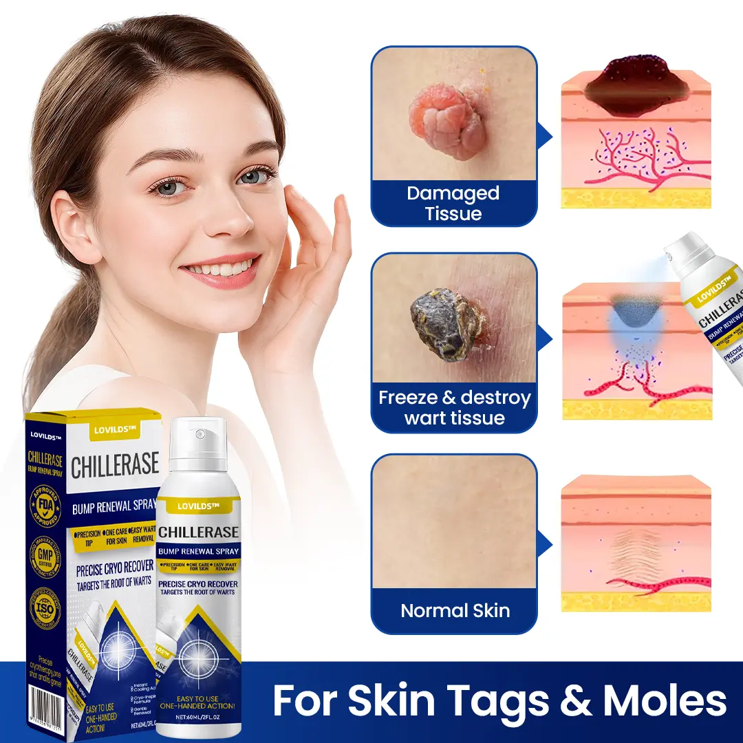 LOVILDS™ ChillErase Bump Renewal Spray