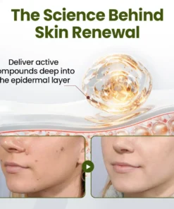 LOVILDS® MagneErase Renewal Cream