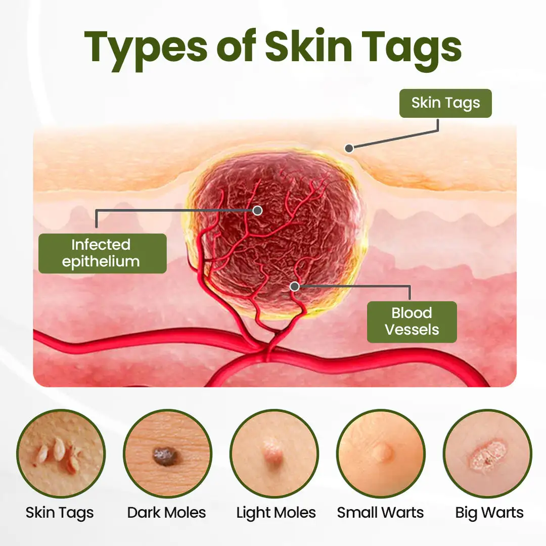 LOVILDS® MagneErase Renewal Cream