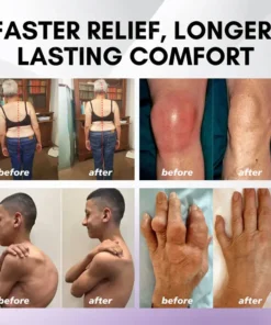 Lovilds™ Turmeric & Emu Oil Arthritis Soothing Pain Relief Massage Gel