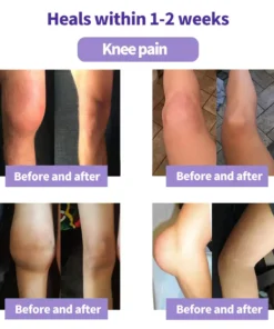 Lovilds™ Turmeric & Emu Oil Arthritis Soothing Pain Relief Massage Gel