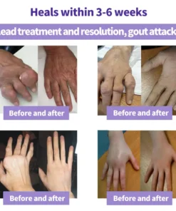 Lovilds™ Turmeric & Emu Oil Arthritis Soothing Pain Relief Massage Gel