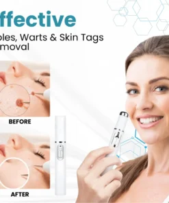 LOVILDS™ Non-Invasive Mole and Wart Removal Laser Pen