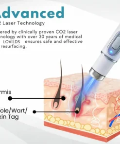 LOVILDS™ Non-Invasive Mole and Wart Removal Laser Pen