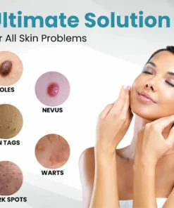 LOVILDS™ Non-Invasive Mole and Wart Removal Laser Pen