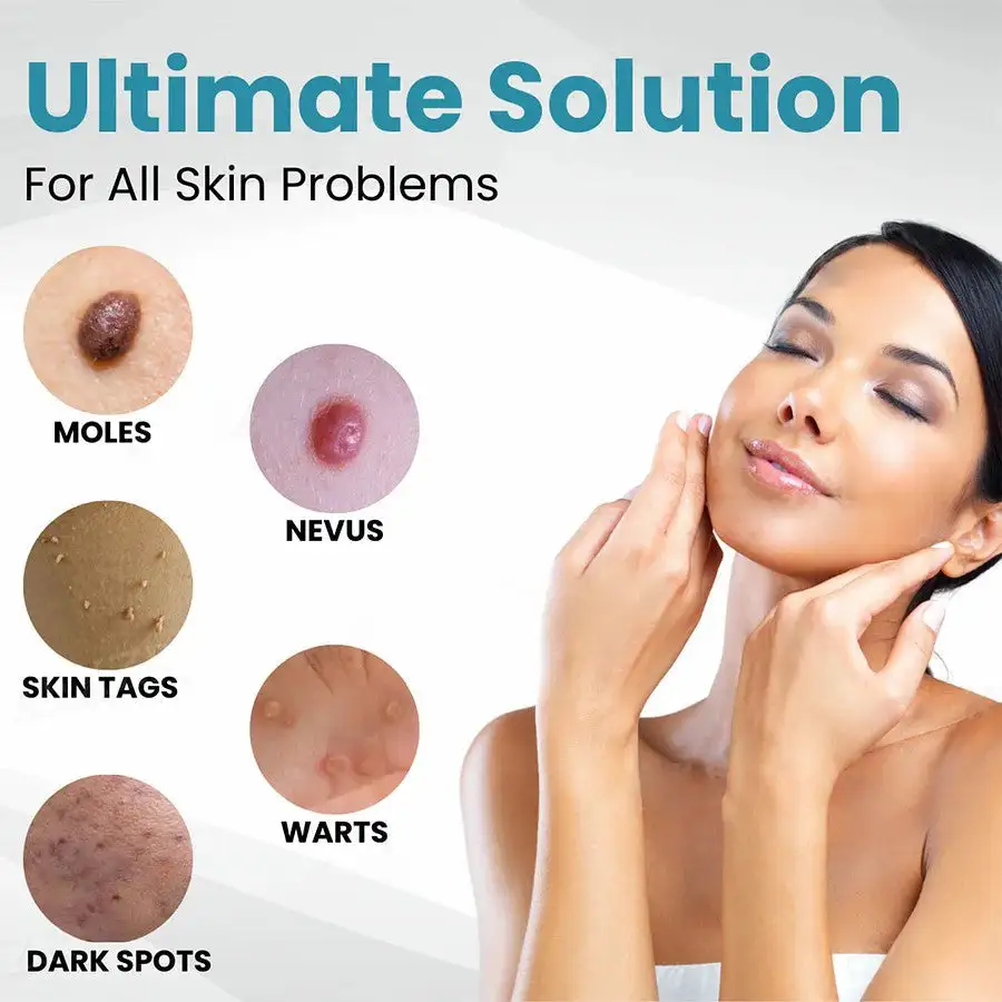 LOVILDS™ Non-Invasive Mole and Wart Removal Laser Pen