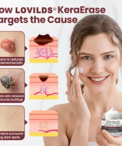 LOVILDS®KeraErase Dual-Action Renewal Cream